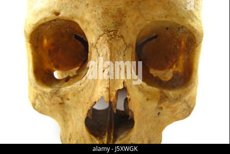 Tod Schädel Knochen toter Kopf Gefahr Tod sterben menschlicher Mensch Schädel Stockfoto