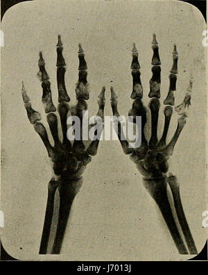 "Industrial Medicine and Surgery" (1919) Stockfoto