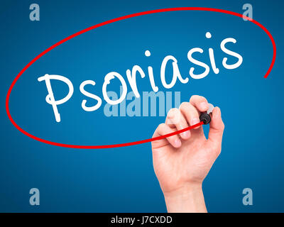 Hand des Mannes Psoriasis mit schwarzem Filzstift auf Bildschirm zu schreiben. Isoliert auf blau. Gesundheit, Technologie, Internet-Konzept. Stock Bild Stockfoto