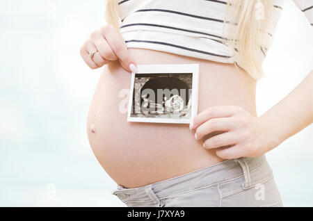 Schwangere Frau mit Ultraschall am Bauch. schwanger Ultraschall Frau Baby Scan Fruchtbarkeit Schwangerschaft Neukonzeption Stockfoto
