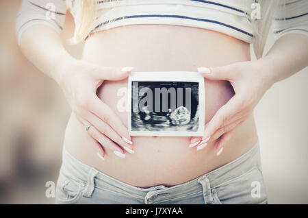 Schwangere Frau mit Ultraschall am Bauch. schwanger Ultraschall Frau Baby Scan Fruchtbarkeit Schwangerschaft Neukonzeption Stockfoto
