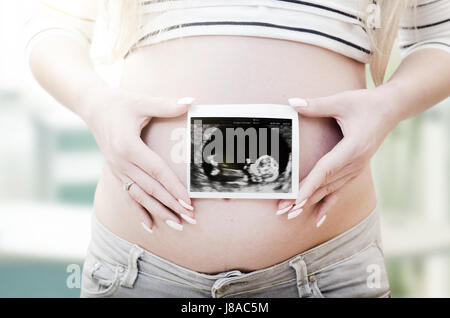 Schwangere Frau mit Ultraschall am Bauch. schwanger Ultraschall Frau Baby Scan Fruchtbarkeit Schwangerschaft Neukonzeption Stockfoto
