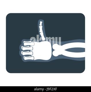 Daumen hoch x-ray. Knochen der Hand zeigt alles gut. Medizinische illustration Stock Vektor