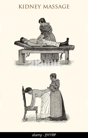 Niere-Massage, Vintage illustration Stockfoto