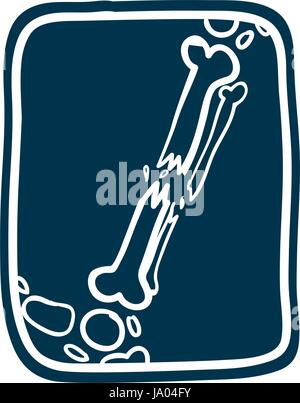 X-Ray Knochen ziehen Stock Vektor