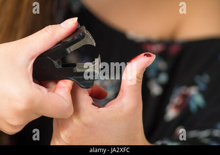 Schließen Sie oben von einer Frau verletzt ihre Finger mit einem schwarzen Grundnahrungsmittel Abzieher Stockfoto