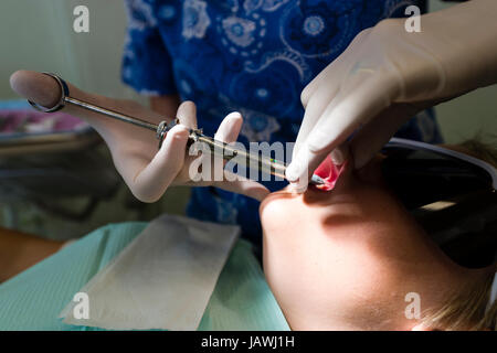 Ein Zahnarzt spritzt einen jungen Mund mit Betäubungsmittel, einen abgebrochenen Zahn mit einer Kappe zu reparieren. Stockfoto