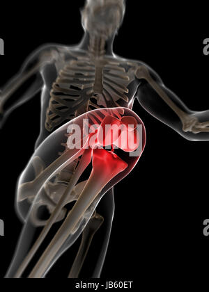 3D gerenderten Illustration - schmerzhafte Knie Stockfoto