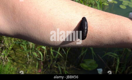 der Blutegel klebte an den Arm eines jungen Mannes. Stockfoto
