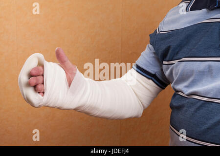 Arm in Gips Stockfoto