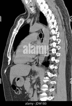 Nahaufnahme von x-ray Stockfoto