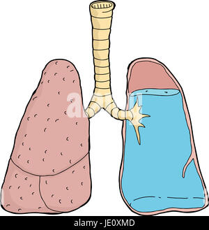 Karikatur von Wasser im menschlichen Lunge Querschnitt Stockfoto