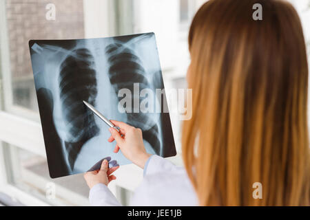 Der Arzt untersucht das Röntgenbild des Patienten Brust. Stockfoto