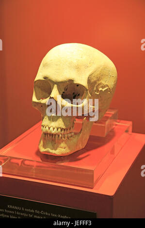 Ggantija Tempel Besucher Zentrum Display Museum, Gozo, Malta Schädel neolithischen Erwachsenfrau Stockfoto