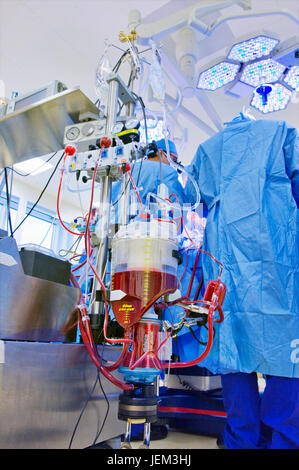 Blut-Reservoir der Perfusion-Maschine, die das Herz & Lunge Funktionen des Patienten mit Coronary Artery Bypass Graft Chirurgie übernommen hat. Stockfoto