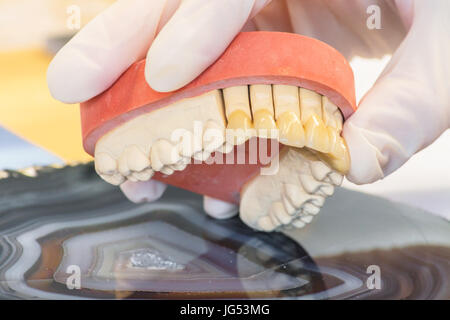 Zahnersatz, Prothesen und Mundhygiene. Hände mit Handschuhen während der Arbeit an einer Zahnprothese. Stockfoto