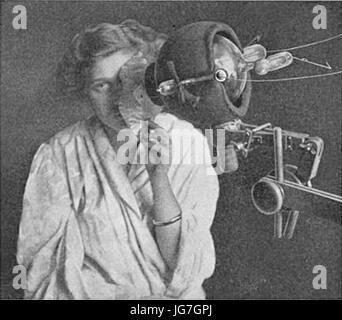Technik der Roentgenotherapy zur Epitheleoma des Gesichts - Behandlung von 1915 Stockfoto
