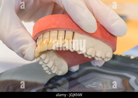 Zahnersatz, Prothesen und Mundhygiene. Hände mit Handschuhen während der Arbeit an einer Zahnprothese. Stockfoto