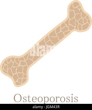 Osteoporose-Knochen-Symbol, Cartoon-Stil Stock Vektor