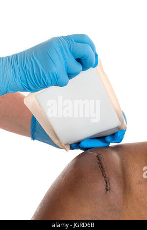 Pflästerchen wurde auf Awound Knopfes Narbe auf weiß angewendet. Stockfoto