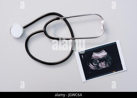 medizinische Stethoskop mit Ultraschall Untersuchungsergebnis auf Tischplatte Stockfoto