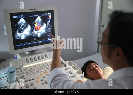 Tam Duc Herzklinik.  Doppler-Echokardiographie.  Ho-Chi-Minh-Stadt. Vietnam. Stockfoto