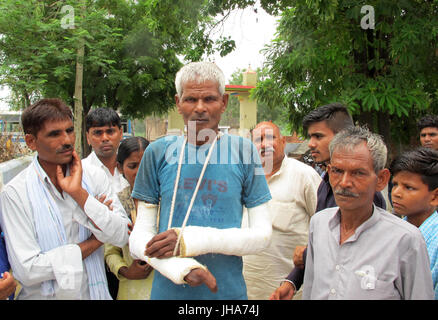 Shabbirpur, Indien. 6. Juli 2017. Inderpal, Mitglied der Dalit Kaste, die während eines Angriffs von Mitgliedern einer höheren Kaste, abgebildet in den nördlichen Dorf Shabbirpur, Indien, 6. Juli 2017 verletzt wurde. Beide Kandidaten bei den indischen Präsidentschaftswahlen am 17. Juli sind Dalits. Dalits, die formal als "Unberührbare" bezeichnet wurden, nach wie vor diskriminiert. Foto: Siddhartha Kumar/Dpa/Alamy Live News Stockfoto