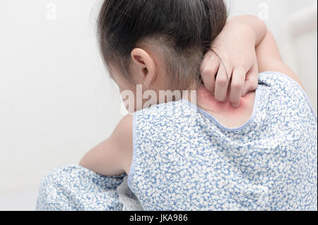 Mädchen kratzen den Juckreiz mit Hand-Konzept mit Gesundheitswesen und Medizin. Stockfoto