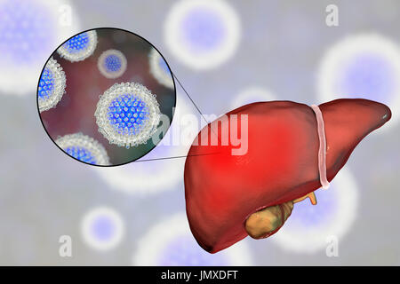Leber mit Hepatitis und Nahaufnahme Blick auf Hepatitis C-Viren, Abbildung. Stockfoto