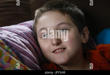 Davenport, Iowa, USA. 12. Januar 2017. Ryan McDermott, 10, lächelt und schaut aus dem Fenster auf die McDermott zu Hause in Davenport auf Donnerstag, 12. Januar 2017. McDermott war als Kleinkind mit Dravet-Syndrom, einer schweren Form von Epilepsie diagnostiziert und hat derzeit zwischen 10 und 20 Anfälle pro Tag. Eine Cannabis-Öl-Studie durch die Universität von Iowa funktionierte nicht für McDermott, aber er wird in Kürze eine Studie durch die Mayo-Klinik namens Fenfluramin Bewertung bei seltenen Epilepsie beginnen. Bildnachweis: Andy Abeyta/Quad-Stadt-Zeiten / ZUMA Draht/Alamy Live News Stockfoto