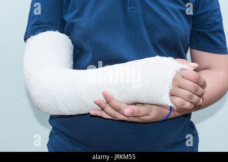 Junge mit gebrochenen Arm, Gips am Arm als Therapie. In der Nähe von white ist ein junger Mann mit langem Arm Gips/Glasfaser Gusseisen für das Handgelenk, Arm und Ellenbogen Stockfoto