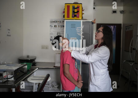 Bogota, Kolumbien. 17 Aug, 2017. Arzt Yinna Martinez arbeitet mit einem Patienten in der Brennen Einheit des Simon Bolivar Krankenhaus in Bogotá, der Hauptstadt Kolumbiens, am 12.08.17., 2017. Nach Angaben der lokalen Presse, Martinez führt ein Projekt der spezielle transparente Masken für Menschen, die tiefe Verbrennungen zweiten Grades im Gesicht erlitten haben, sowie andere Kunststoff Elemente für verschiedene Körperteile. Credit: Jhon Paz/Xinhua/Alamy leben Nachrichten Stockfoto