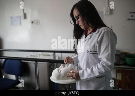 Bogota, Kolumbien. 17 Aug, 2017. Arzt Yinna Martinez arbeitet auf der Gipsabdruck von einem Gesicht am Brennen Einheit des Simon Bolivar Krankenhaus in Bogotá, der Hauptstadt Kolumbiens, am 12.08.17., 2017. Nach Angaben der lokalen Presse, Martinez führt ein Projekt der spezielle transparente Masken für Menschen, die tiefe Verbrennungen zweiten Grades im Gesicht erlitten haben, sowie andere Kunststoff Elemente für verschiedene Körperteile. Credit: Jhon Paz/Xinhua/Alamy leben Nachrichten Stockfoto