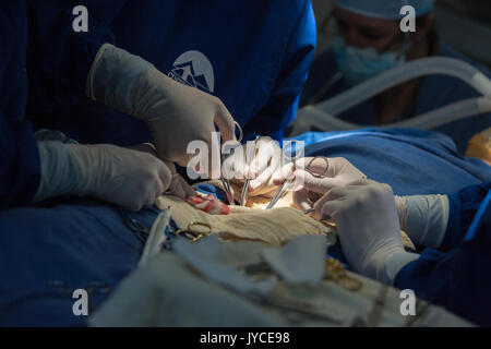 Liebe Chirurgie in kleinen Städten Ecuadors durchgeführt durch CinterAndes am 27. Mai 2014 Stockfoto