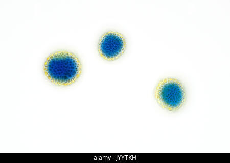 Pollenkörner (Sporen) von einem Air Probe, gefärbt mit blau Methyl, helle Arbeitsscheinwerfer Schliffbild, Größe der einzelnen Teilchen 17-22 Mikrometer Stockfoto