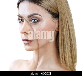 Erwachsene Frau mit Akne vor und nach der Behandlung. Stockfoto