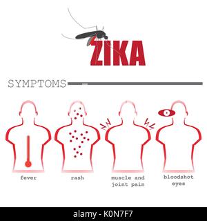 Zika virus Häufigsten Symptome. Vektorformat Infografik Abbildung Stock Vektor