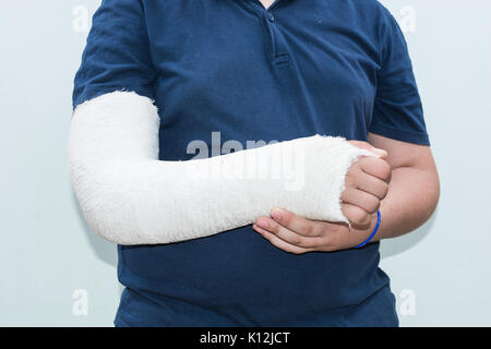 Junge mit gebrochenen Arm, Gips am Arm als Therapie. In der Nähe von white ist ein junger Mann mit langem Arm Gips/Glasfaser Gusseisen für das Handgelenk, Arm und Ellenbogen Stockfoto