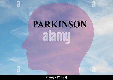 Render Abbildung: Parkinson Titel auf dem Kopf silhouette, mit bewölktem Himmel als Hintergrund. Stockfoto