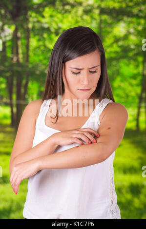 Nahaufnahme der jungen Frau mit itch Mückenstichen, in einem verschwommenen Hintergrund Stockfoto