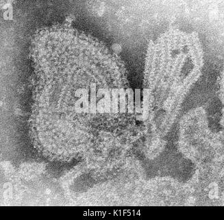 Dieses 1976 negativ gefärbten Transmission Electron Micrograph (TEM) der Ultrastrukturforschung Funktionen durch das Mumpsvirus angezeigt, dargestellt. Bild mit freundlicher Genehmigung von CDC/Dr. F.A. Murphy, 1976. Stockfoto