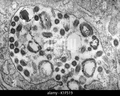 Transmission Electron Micrograph (TEM) der Marburg Virus. Marburg Virus, erstmals 1967 erkannt, verursacht eine schwere Form der hämorrhagischen Fieber, was Auswirkungen auf die Menschen, als auch nicht-menschlichen Primaten. Bild mit freundlicher Genehmigung von CDC/Dr. Fred Murphy, Sylvia Whitfield, 1975. Stockfoto