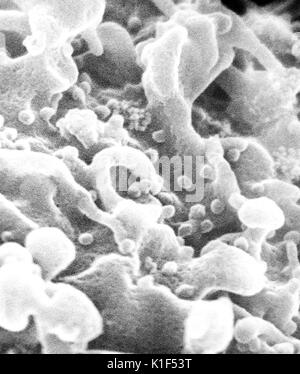 Scanning Electron Micrograph der Human Immunodeficiency Virus (HIV), in kultivierten Lymphozyten gewachsen. Virionen werden als kleine Kugeln auf der Oberfläche der Zellen. Mit freundlicher CDC/Cynthia Goldsmith, S. Feorino, E.L. Palmer, W.R. McManus, 1984. Stockfoto