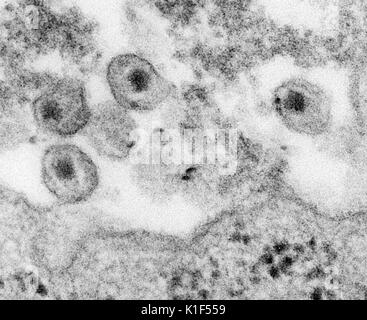 Transmission Electron Micrograph (TEM), Human Immunodeficiency Virus (HIV), in Zusammenarbeit mit menschlichen Lymphozyten kultiviert. Bild mit freundlicher Genehmigung von CDC/A. Harrison, S. Feorino, E.L. Palmer, 1984. Stockfoto