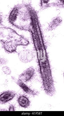 Eingefärbte Transmission Electron Micrograph des Ebola-virus. Hämorrhagische Fieber, RNA-Virus. Mit freundlicher CDC/Cynthia Goldsmith. 1990. Stockfoto