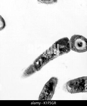 Transmission Electron Micrograph von Bacillus anthracis. Transmission Electron micrographic Bild von Bacillus anthracis. Bild mit freundlicher Genehmigung von CDC/Dr. Sherif Zaki, Elizabeth Weiß, 2001. Stockfoto