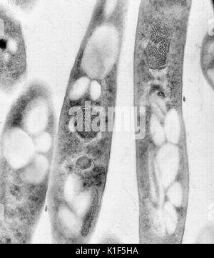 Transmission Electron Micrograph von Bacillus anthracis. Transmission Electron micrographic Bild von Bacillus anthracis. Bild mit freundlicher Genehmigung von CDC/Dr. Sherif Zaki, Elizabeth Weiß, 2001. Stockfoto