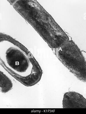 Transmission Electron Micrograph von Bacillus anthracis. Transmission Electron micrographic Bild von Bacillus anthracis Milzbrand aus einer Kultur, die die Zellteilung (A) und Sporen (B). Bild mit freundlicher Genehmigung von CDC/Dr. Sherif Zaki, Elizabeth Weiß, 2001. Stockfoto