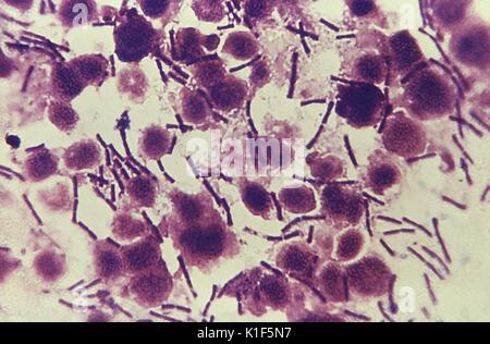 Diese photomicrograph zeigt zahlreiche stäbchenförmige Bakterien Bacillus anthracis, einige, die miteinander verknüpft hatte, Ketten zu bilden, während andere allein geblieben. Anthrax ist eine natürlich vorkommende Krankheit von Tieren (z.b. Schafe, Ziegen und Rinder), die durch das Bakterium Bacillus anthracis. Die Bakterien leben in der Erde in vielen Teilen der Welt und bilden äußere Schichten als Sporen (nachstehend Anthrax Sporen). Die Sporen sind in der Lage, scharfe oder ungünstigen Bedingungen, die normalerweise Bakterien töten würden, standzuhalten. Tiere können durch Einnahme von Anthrax anthrax Sporen aus dem Boden. Milzbrand in Tiere Stockfoto