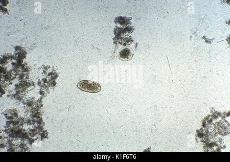 128 X, vergrößert diese photomicrograph enthüllte der Ultrastrukturforschung Funktionen, die von einem unfruchtbaren, geschält Ascaris lumbricoides Ei angezeigt. Befruchtete und unbefruchtete A. lumbricoides Eier im Stuhl der infizierten Host weitergeleitet werden. Befruchtete Eier sind abgerundet und haben eine dicke Schale mit einem externen mammillated Schicht, oft Braun ist befleckt von Galle. In einigen Fällen, die äußere Schicht ist nicht vorhanden (Als geschältes Eier bekannt). Fruchtbare eier Angebot von 45 {Micro}m 75{Mikro} m in der Länge. Unbefruchtete Eier sind länglich und größer als fruchtbaren Eier (bis zu 90{Mikro} m in der Länge). Ihre s Stockfoto